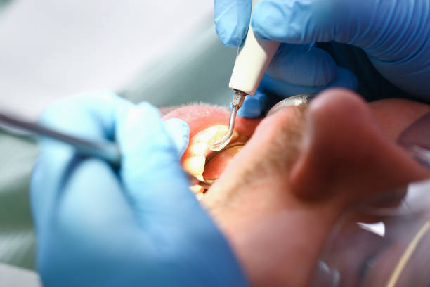 Best Emergency Root Canal Treatment in Mickleton, NJ